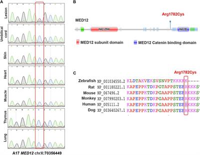 Somatic and de novo Germline Variants of MEDs in Human Neural Tube Defects